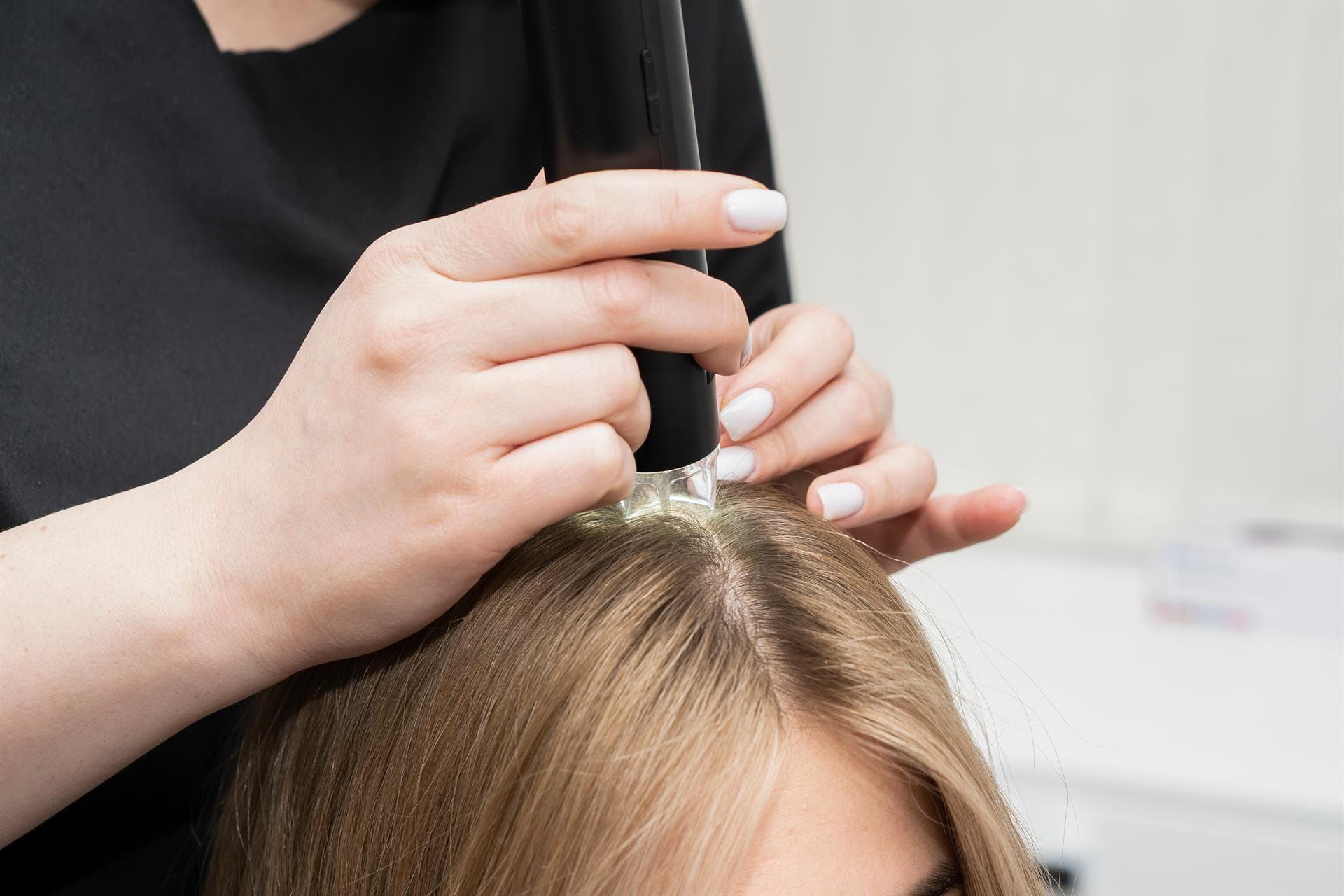 ¡Te ayudamos a evitar la pérdida del cabello en Cambados!